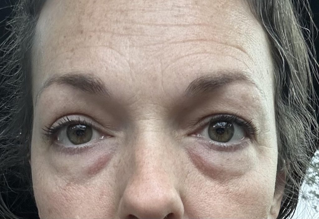 Immagine #1 da Giulia A.