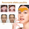 Silikónová pleťová maska ​​na vrásky na čele